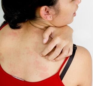 Granulomas corporales síntomas de la presencia de parásitos.